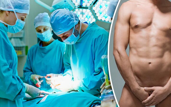 Aumento chirurgico del pene